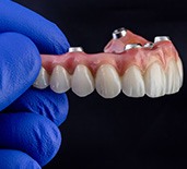 Person holding an implant denture